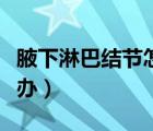 腋下淋巴結節(jié)怎么消除（腋下淋巴結腫大怎么辦）