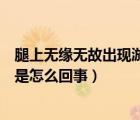 腿上無緣無故出現(xiàn)淤青是什么情況（腿上無緣無故出現(xiàn)淤青是怎么回事）