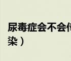 尿毒癥會不會傳染給下一代（尿毒癥會不會傳染）