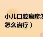 小兒口腔皰疹怎么治療最有效（小兒口腔皰疹怎么治療）