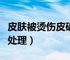 皮膚被燙傷皮破了怎么辦（皮膚燙傷破皮怎么處理）
