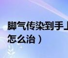 腳氣傳染到手上怎么治療呢（腳氣傳染到手上怎么治）