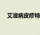 艾滋病皮疹特點(diǎn)對稱（艾滋病皮疹特點(diǎn)）