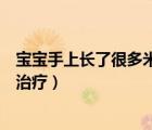 寶寶手上長了很多米粒樣的小疙瘩（寶寶手上長小疙瘩怎么治療）