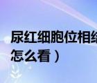 尿紅細(xì)胞位相結(jié)果怎么看（尿紅細(xì)胞位相報告怎么看）