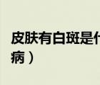皮膚有白斑是什么病圖片（皮膚有白斑是什么病）