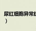 尿紅細(xì)胞異常紅細(xì)胞（尿紅細(xì)胞異常怎么回事）