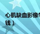心肌缺血影像學(xué)表現(xiàn)（心肌缺血mri檢查多少錢）