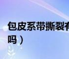 包皮系帶撕裂有事嗎圖片（包皮系帶撕裂有事嗎）