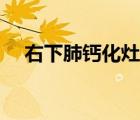 右下肺鈣化灶嚴重嗎（肺鈣化灶嚴重嗎）
