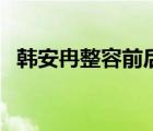 韓安冉整容前后照片（謝娜整容前后照片）