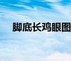 腳底長(zhǎng)雞眼圖片（腳底長(zhǎng)雞眼怎么根治）