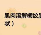 肌肉溶解橫紋肌溶解癥癥狀（橫紋肌溶解癥癥狀）