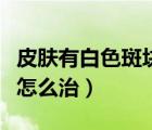 皮膚有白色斑塊是怎么回事（皮膚有白色斑點怎么治）