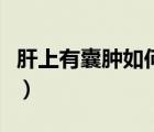 肝上有囊腫如何治療好（肝上有囊腫如何治療）