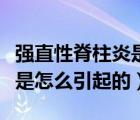 強(qiáng)直性脊柱炎是怎么引起的?。◤?qiáng)直性脊柱炎是怎么引起的）