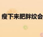 瘦下來(lái)肥胖紋會(huì)消失嗎（肥胖紋可以消除嗎）