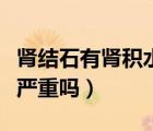 腎結(jié)石有腎積水嚴(yán)重嗎女性（腎結(jié)石有腎積水嚴(yán)重嗎）