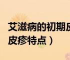 艾滋病的初期皮疹特點(diǎn)一個(gè)月（艾滋病的初期皮疹特點(diǎn)）