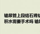 輸尿管上段結(jié)石腎結(jié)石伴有腎積水輕度（輸尿管狹窄導(dǎo)致腎積水需要手術(shù)嗎 輸尿管狹窄導(dǎo)致腎積水需不需要手術(shù)治療）