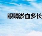 眼睛淤血多長時(shí)間可以消除（眼睛淤血）
