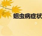 蛔蟲(chóng)病癥狀判斷方法（蛔蟲(chóng)病癥狀）