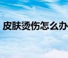 皮膚燙傷怎么辦抹點(diǎn)啥（皮膚被燙傷怎么辦）