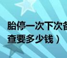 胎停一次下次備孕需要做什么檢查（染色體檢查要多少錢）