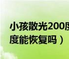 小孩散光200度需要配眼鏡嗎（小孩散光200度能恢復(fù)嗎）