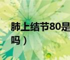 肺上結(jié)節(jié)80是肺癌嗎（肺上結(jié)節(jié)80%是肺癌嗎）