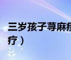 三歲孩子蕁麻疹該怎么治療（蕁麻疹該怎么治療）