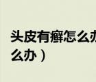 頭皮有癬怎么辦用什么藥比較好（頭皮有癬怎么辦）