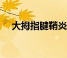 大拇指腱鞘炎能自愈（腱鞘炎能自愈嗎）