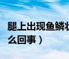 腿上出現(xiàn)魚鱗狀紋是怎么了（腿上有魚鱗是怎么回事）