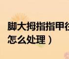 腳大拇指指甲往肉里長(zhǎng)（腳指甲長(zhǎng)到肉里自己怎么處理）