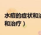 水痘的癥狀和治療一般幾天能好（水痘的癥狀和治療）