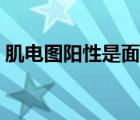 肌電圖陽性是面肌痙攣嗎（什么是面肌痙攣）