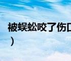 被蜈蚣咬了傷口圖片（被蜈蚣咬了應(yīng)該怎么辦）