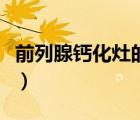 前列腺鈣化灶的危害（前列腺鈣化灶怎么消除）