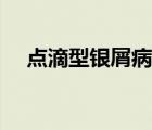 點滴型銀屑病消退特點（點滴型銀屑?。?/>
                                    </a>
                                                </div>
                                    <div   id=