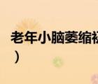 老年小腦萎縮初期的癥狀（腦萎縮初期的癥狀）
