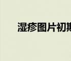 濕疹圖片初期癥狀圖片（濕疹會癢嗎）