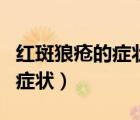 紅斑狼瘡的癥狀和腿疼有關(guān)系嗎（紅斑狼瘡的癥狀）