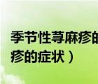季節(jié)性蕁麻疹的癥狀和治療方法（季節(jié)性蕁麻疹的癥狀）