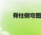 脊柱側(cè)彎圖片真人（脊柱側(cè)彎圖片）