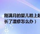 剛滿月的嬰兒臉上起了好多濕疹怎么辦（剛滿月的寶寶臉上長(zhǎng)了濕疹怎么辦）