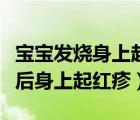 寶寶發(fā)燒身上起紅疹子是什么原因（寶寶發(fā)燒后身上起紅疹）