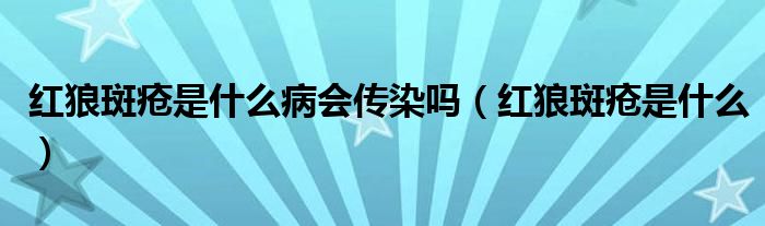 紅狼斑瘡是什么病會(huì)傳染嗎（紅狼斑瘡是什么）