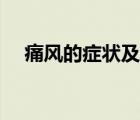 痛風(fēng)的癥狀及治療方法（小兒驚風(fēng)癥狀）