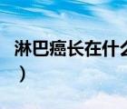 淋巴癌長在什么部位（淋巴癌都長在什么地方）